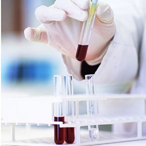 أنابيب اختبار بلاستيكية مع رف والقبعات، 16 × 100mm مع حامل للتجارب العلمية، حبات سائلة 2