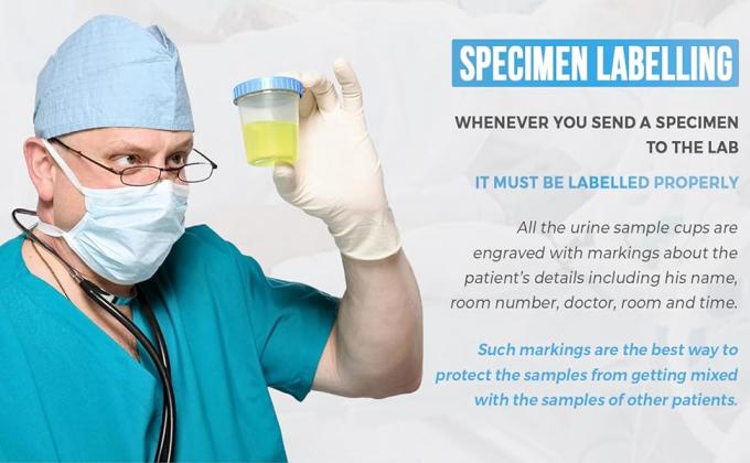 إمداد كؤوس العينة مع أغطية - غطاء ضد التسرب - بلاستيك البولي بروبلين عالي الجودة خالي من اللاتكس - غير معقمة - 25 4 أوقية 4