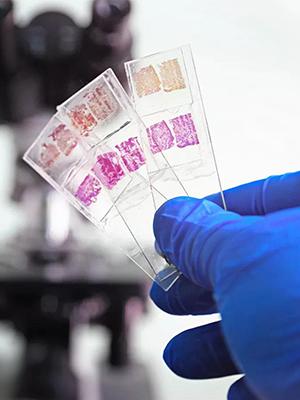 شرائح المجهر والغلافات، شرائح الزجاج الفارغة لمجموعة المجهر - 300 شريحة، 300 غلاف، للمجهر 1